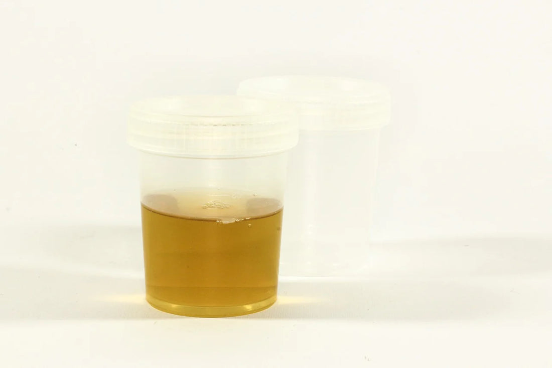 Blood in Urine