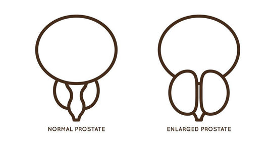 Does an Enlarged Prostate Affect a Man Sexually?