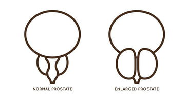 Does an Enlarged Prostate Affect a Man Sexually?