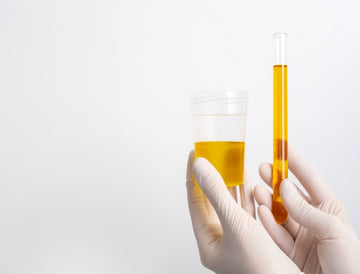 How to Reduce Calcium Oxalate in Urine?