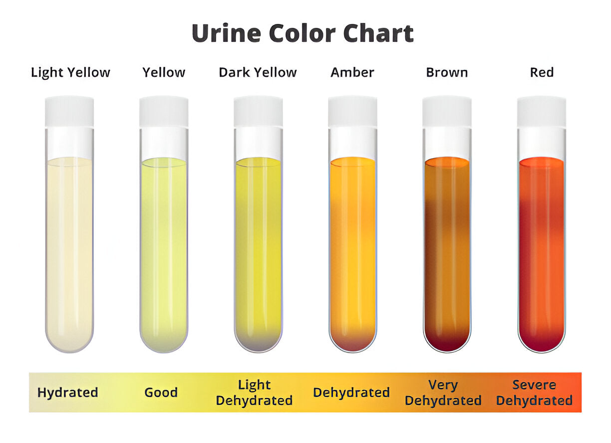 Urine Colour Chart: Know What’s Normal and When to Seek Help