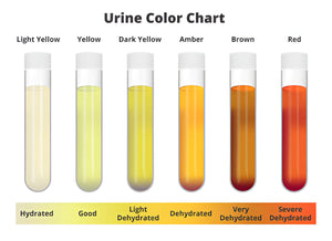 Urine Colour Chart: Know What’s Normal and When to Seek Help