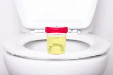 Foamy Urine (Bubbly Pee) in Women: Everything You Need to Know