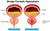 Prostate Size: What’s Considered Normal and When to Be Concerned