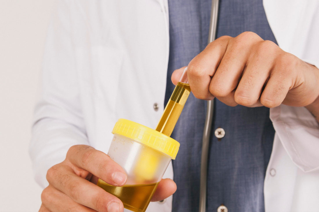 Understanding High Calcium in Urine: Causes, Symptoms, and Treatments