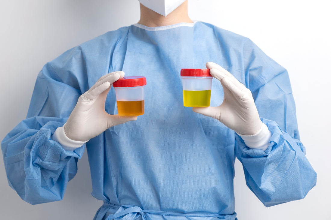 From Blood to Bladder: The Essential Steps in Urine Formation