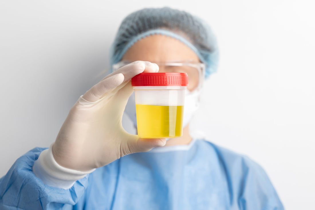 Can UTI Cause Protein in Urine?