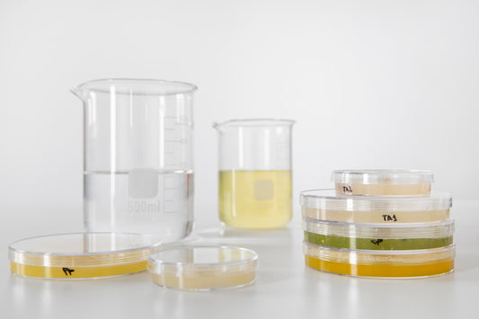 Crystals in Urine? What They Mean for Your Health and Well-Being