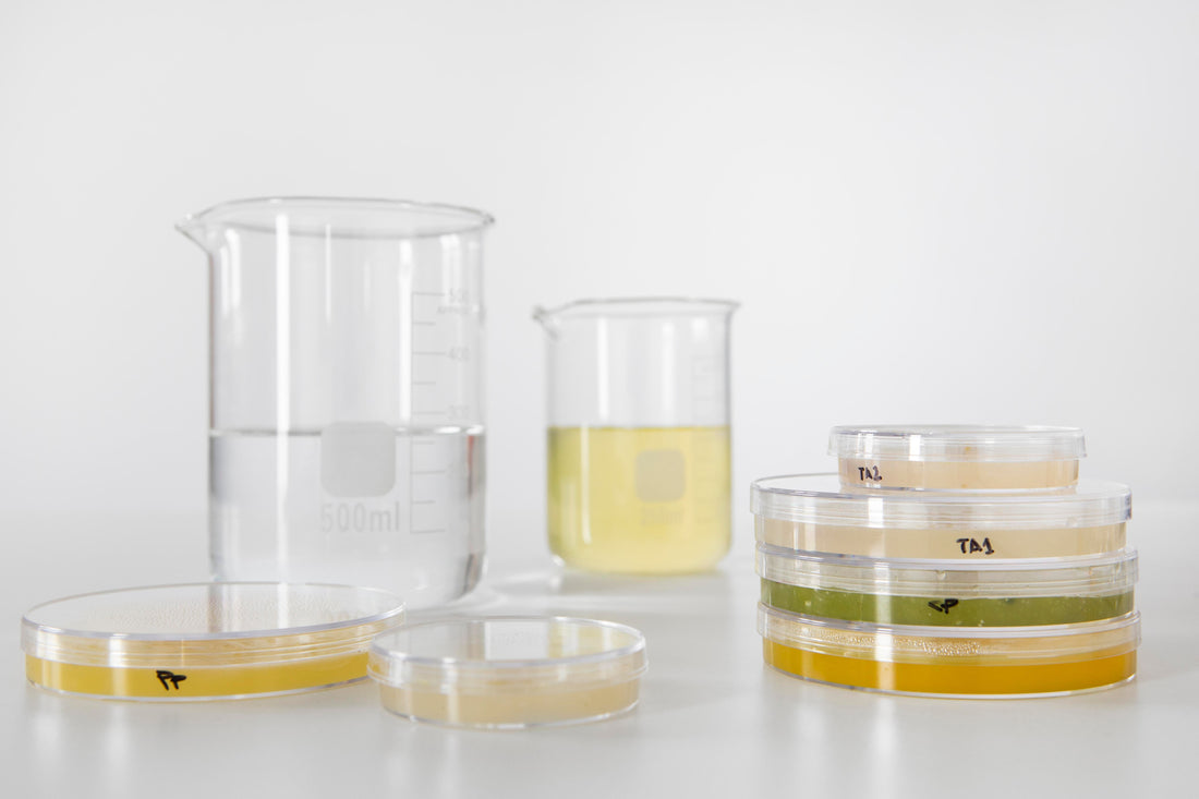 Crystals in Urine? What They Mean for Your Health and Well-Being