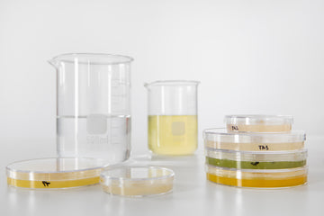 Crystals in Urine? What They Mean for Your Health and Well-Being