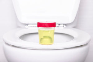 Foamy Urine in Women: Everything You Need to Know